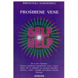 Proširene vene