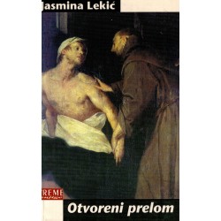 Otvoreni prelom